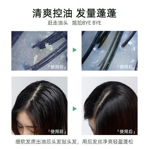 域发白柳皮控油洗发水露清爽控油平衡去屑无硅油头皮营养液官JX2 - 图2
