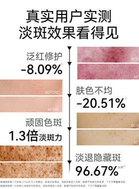 TNN377美白精华去黄提亮淡斑淡印