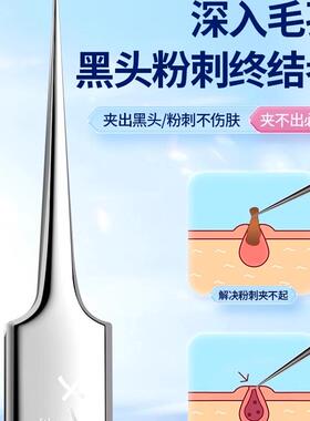 小天籁细胞夹黑头超细医用粉刺针