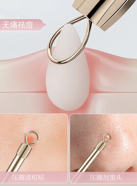 粉刺针去黑头工具挑挤痘痘神器美容专用刮闭口超细暗疮讽刺针套装