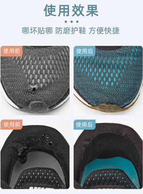 运动鞋补洞贴网面修补破