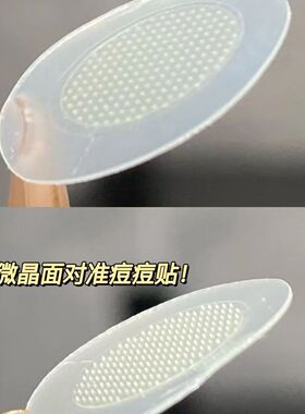 痘痘贴修复消言去痘印
