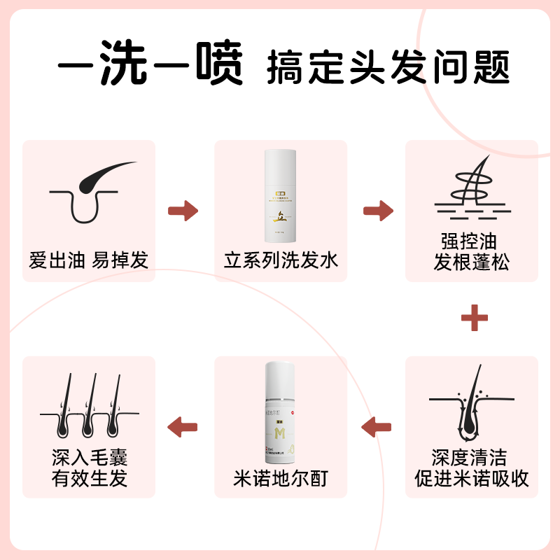  蔓迪白发脱发
