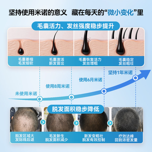 蔓迪5%浓度米诺地尔酊男士生发液官方旗舰店正品防脱洗发水非搽剂 - 图0