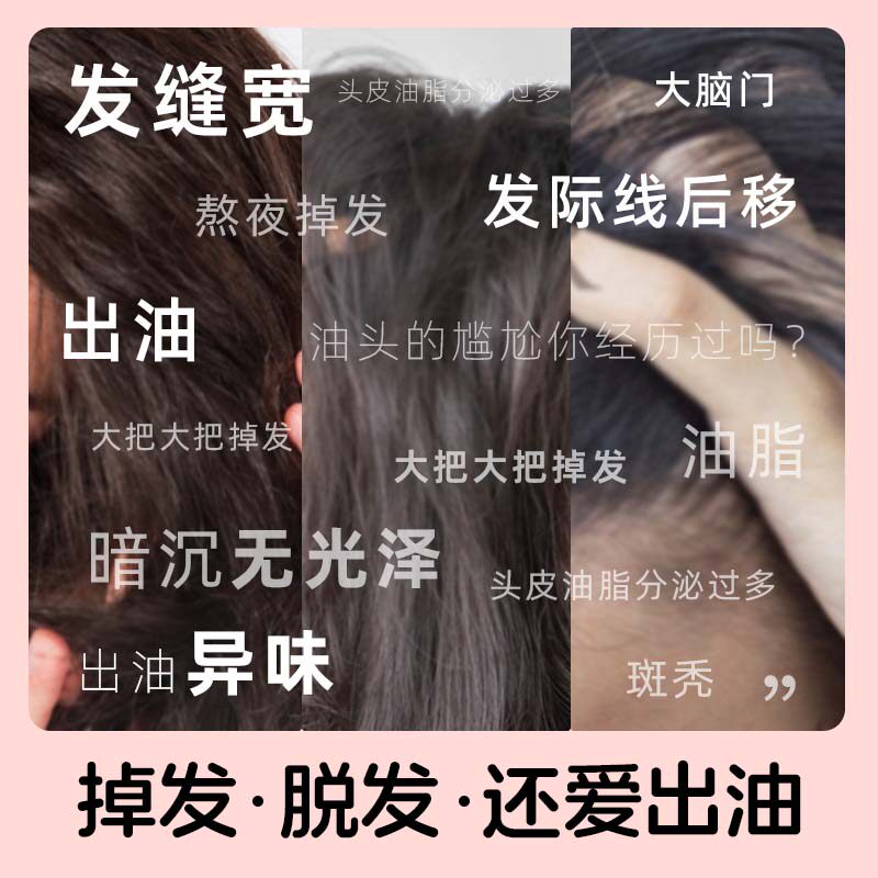  蔓迪白发脱发