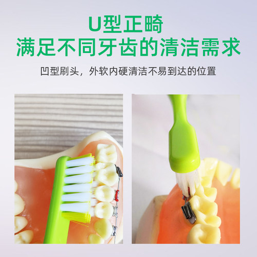 益口佳笔握式正畸牙刷4支U型软毛牙齿矫正口腔带牙套牙箍矫治清洁 - 图1