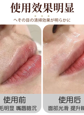 唇毛去除器无痛脸部脱毛腋窝脱毛神器腿毛腋下子面部汗毛刮毛刀