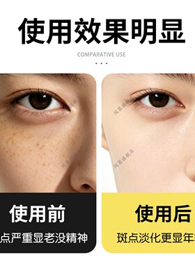 淡斑贴美白淡化色斑去黄褐斑脸部暗沉提亮贴去黑防皱眉川字纹贴