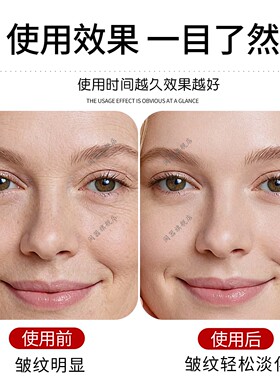 睡觉防皱纹贴侧睡防法令纹神器川字抬头纹淡化提拉神器防皱眉贴