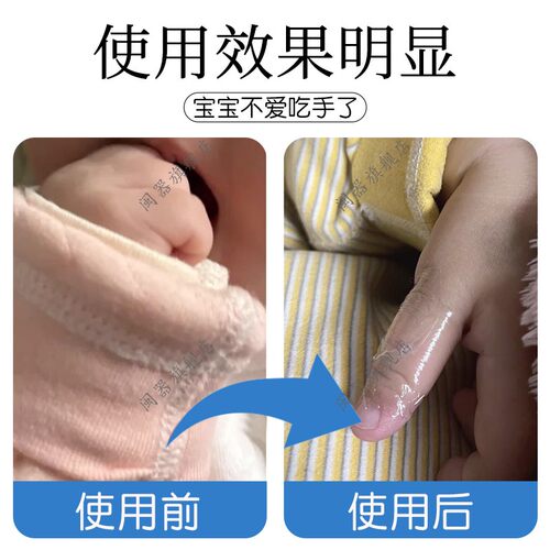 宝宝戒吃手指神器防止小孩咬指甲神器儿童咬指甲戒吃手防啃手指 - 图3