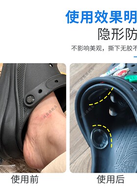 洞洞鞋防磨贴脚背侧边鞋扣皮肤防磨贴防刮擦防痛保护缓冲垫隐形