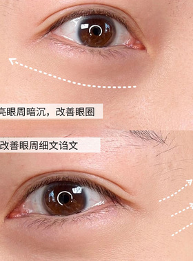 【加入会员】修丽可AGE眼霜15ml
