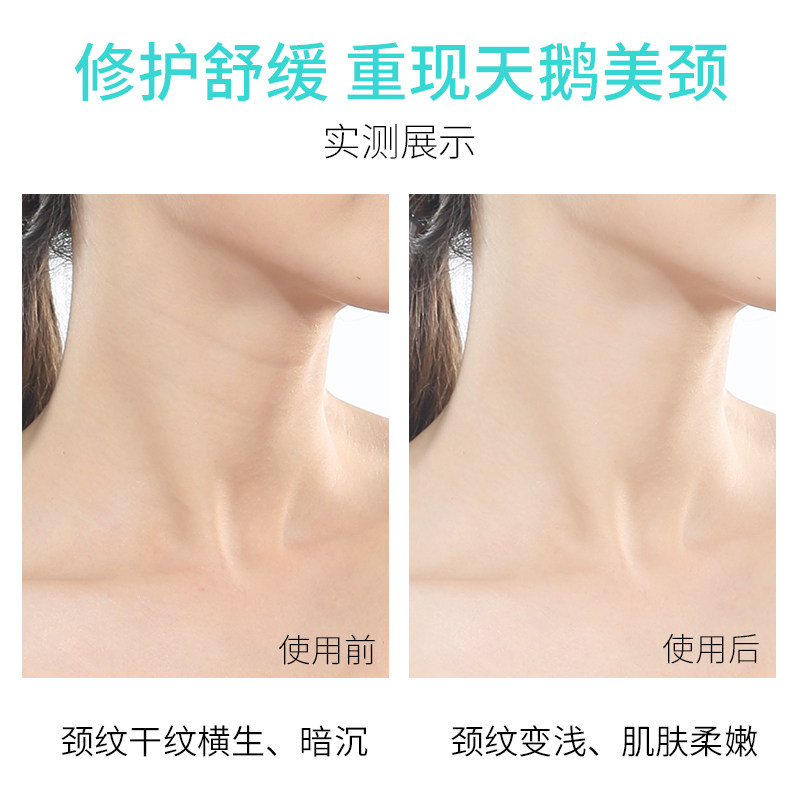 润凰双滚轮v型提亮淡纹颈霜美颈膜 润凰颈霜