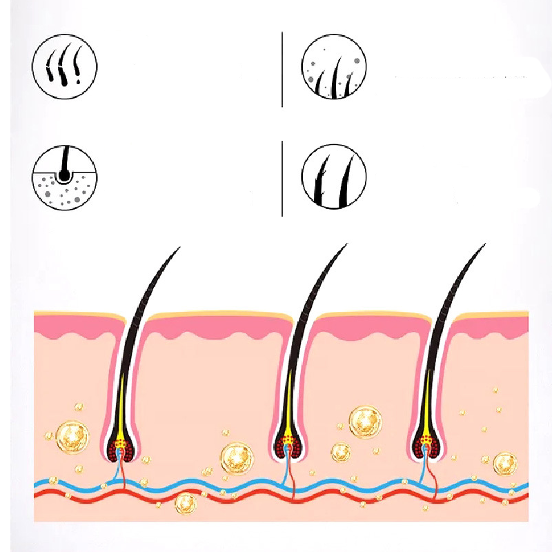 豫宁美毛囊藓清保健液150ml洗发水 康立特医疗器械皮肤消毒护理（消）