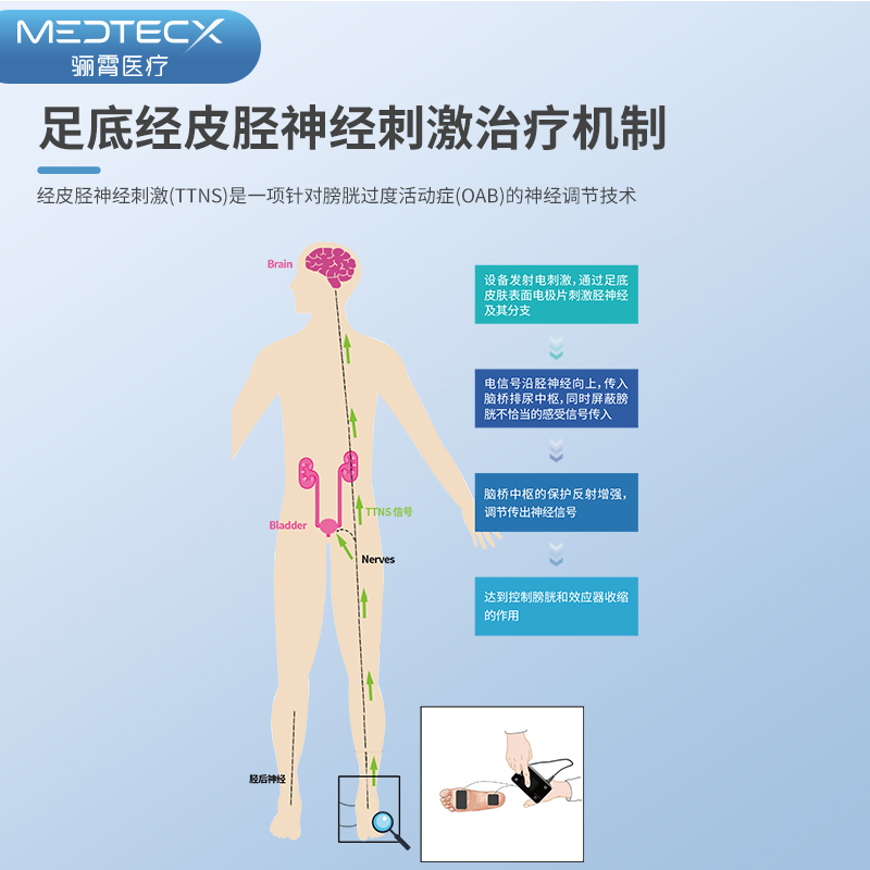 泉愈无创低频足底胫神经刺激器ttns膀胱过度活动症尿急尿频尿失禁 - 图0