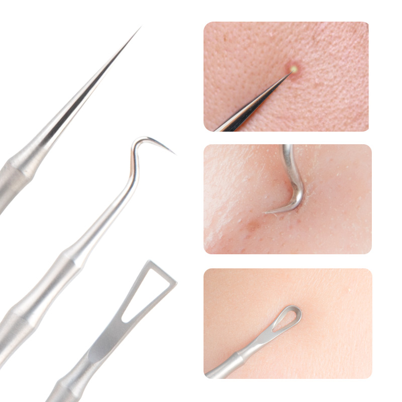 粉刺针清痘针豆豆排痘挤痘痘闭口刮挑暗疮针单只超尖套装神器夹子 - 图1