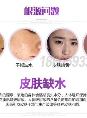 欧果玻尿酸修复原液精华液正品