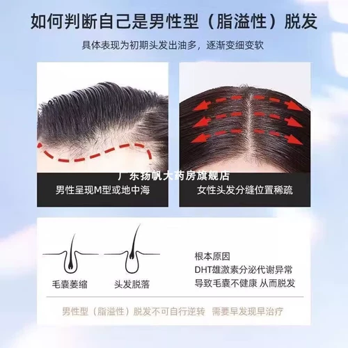 [Манди] Миноксидилстойка 5%*60 мл*2 бутылки/коробка для мужчин и женщин выпадение волос и алопеция, устойчивая