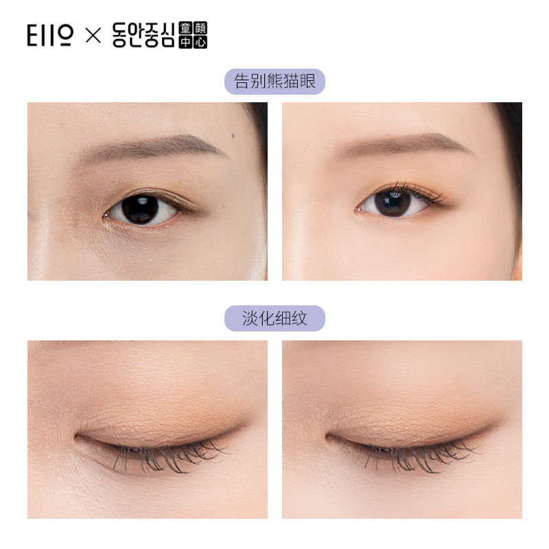 慕恩化妆品专营店EIIO眼霜去黑眼圈淡化眼袋提拉紧致抗皱细纹补水保湿正品男女学生3