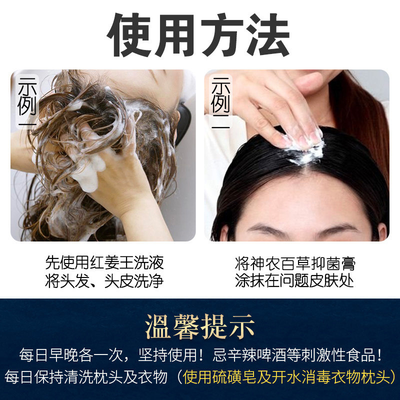 神农百草膏红姜王毛囊用头皮洗发水 碧缇福医疗器械皮肤消毒护理（消）
