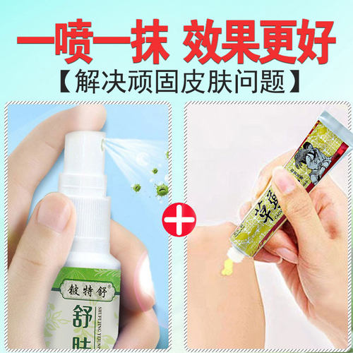 东方之骄草药王抑菌乳膏中草药软膏草乐王药王草本手心痒痒非药膏 - 图2