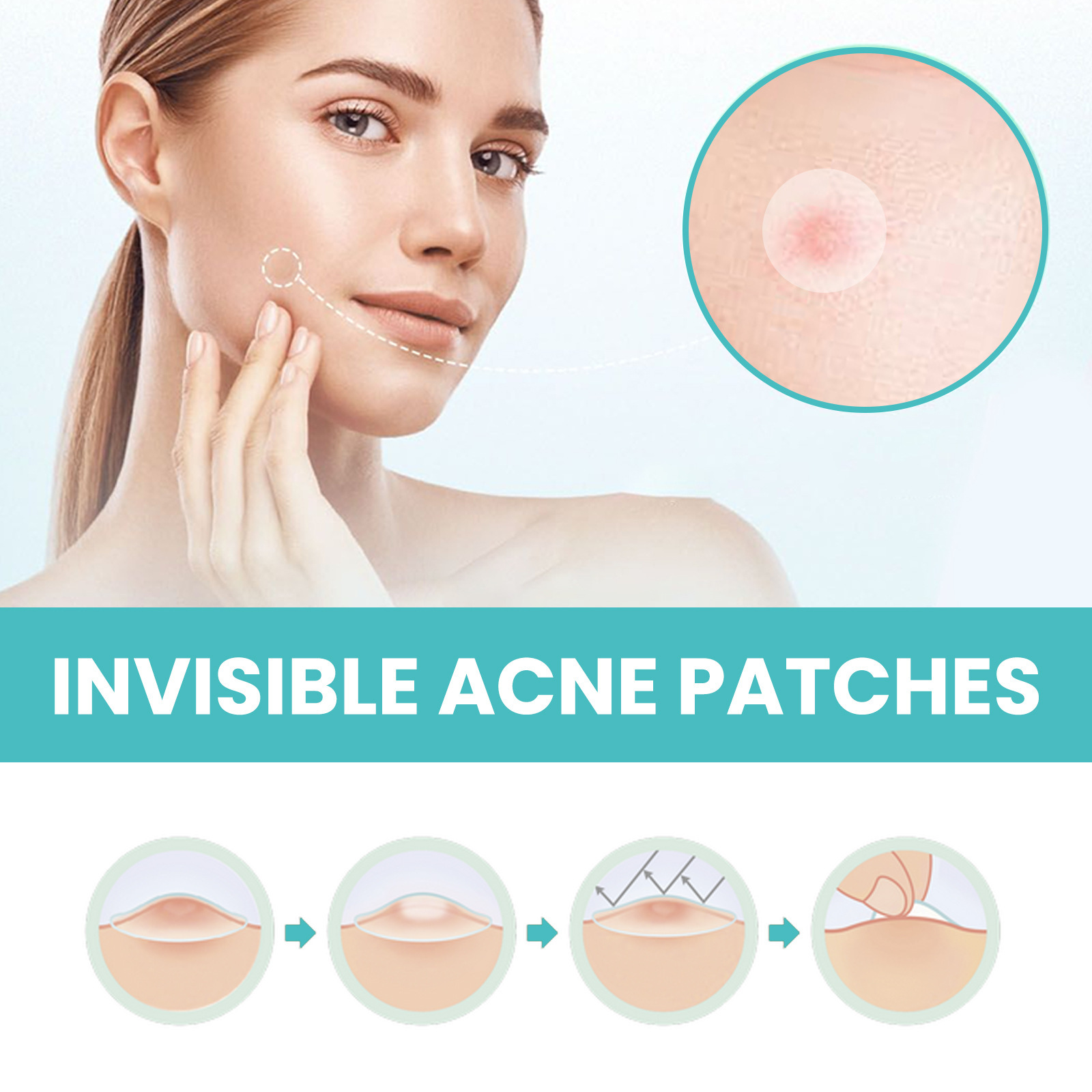 West & Month Acne Patch For Repairing Acne And Acne - 图1