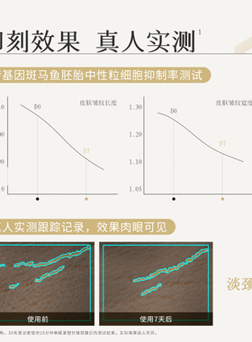 枫缇紧塑抗皱颈膜颈纹贴透明质酸钠颈部护理劲膜面膜5片/盒