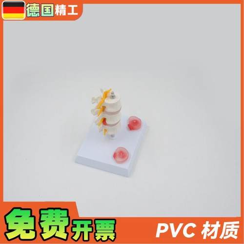 德国】PNT0131三节腰椎带病变椎间盘病变椎间盘骨骼X模型骨科疼痛 - 图0