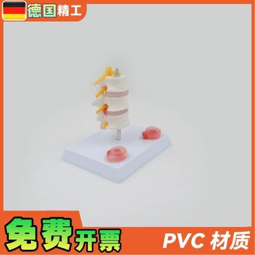 德国】PNT0131三节腰椎带病变椎间盘病变椎间盘骨骼X模型骨科疼痛 - 图2