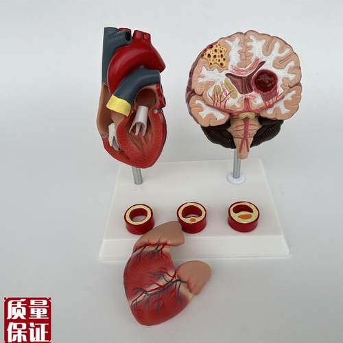 人体心脑血管展示模型血压高心脏模具L与心血管模型对比教具模 - 图1