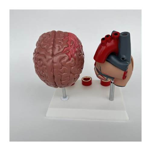 人体心脑血管展示模型血压高心脏模具L与心血管模型对比教具模 - 图3