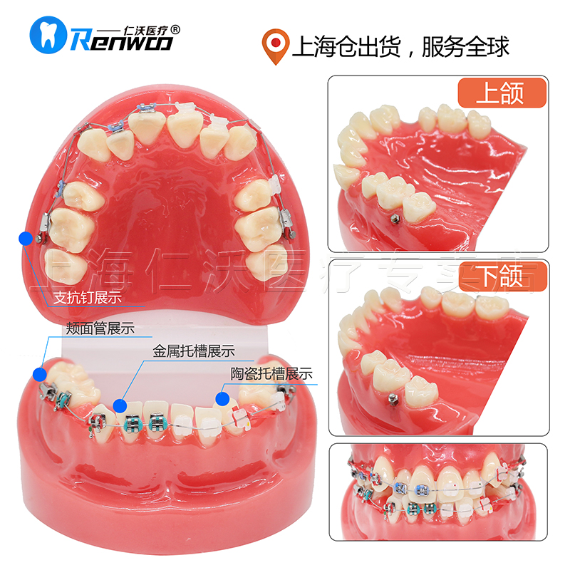 牙齿模型牙模型牙科教学模型种植牙备牙正畸病理口腔模型-图1