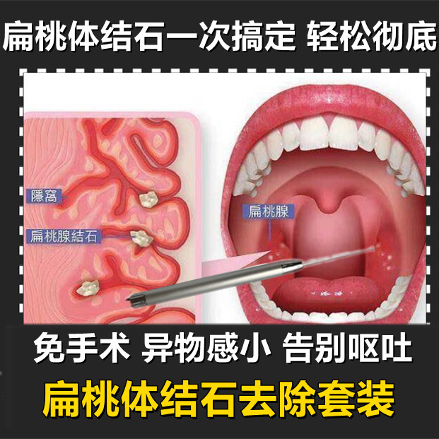祛除扁桃体结石推荐品牌 新人首单立减十元 21年6月 淘宝海外 祛除扁桃体结石推荐品牌 新人首单立减十元 21年6月 淘宝海外