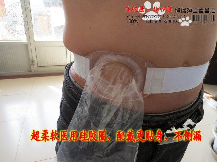 造口袋二件式腰带一次性造瘘口袋子底盘肛门便袋造口腹带护理用品 - 图2