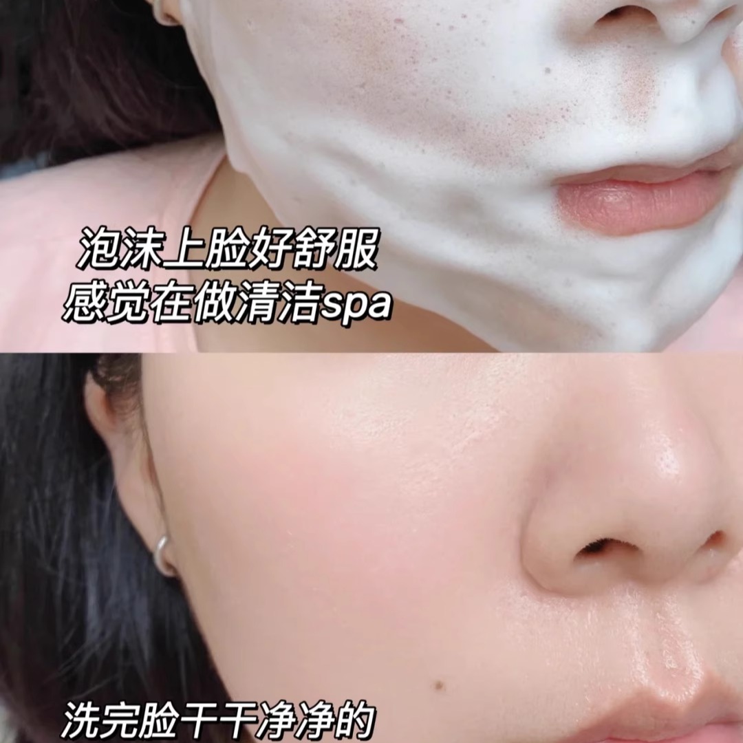 真丽斯氨基酸洁面慕斯泡沫洗面奶男女清洁补充装保湿修护官方正品 - 图1