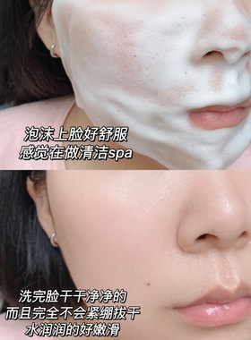 真丽斯氨基酸洁面慕斯补充装泡沫洗面奶女清洁保湿修护二裂酵母