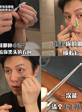 黑头夹~5号超尖细胞夹去黑头神器闭口镊子超细挑粉刺痘痘美容院