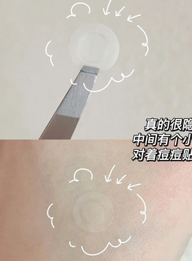 韩国oliveyoung痘痘贴轻薄隐形