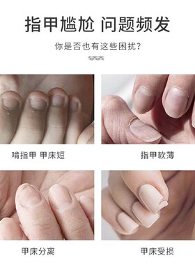 琥珀酸底油护理强韧硬甲水分层修复易断变硬改善薄软脆分层提光泽