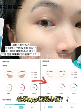 KOSMEA月光滚珠眼部精华油9ml