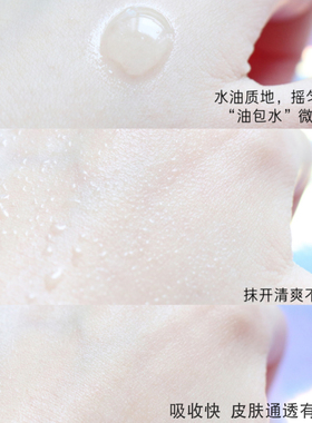 兰蔻极光水150ml去闭口痘痘混油