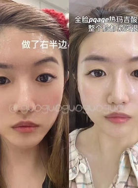 意大利Promoitalia提拉酸热马吉