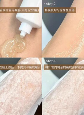 痛感强！【白瓷娃娃】韩国院线En Dehors碳酸灌注CO2注氧皮肤净化