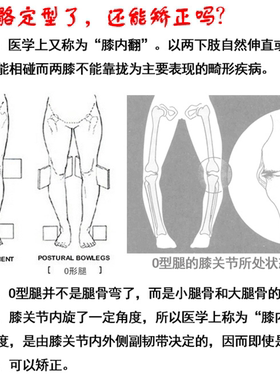 身姿腿型弯曲内外八字神器矫正带