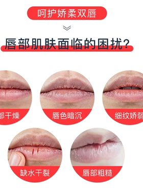 Vaseline凡士林润唇膏滋润唇部