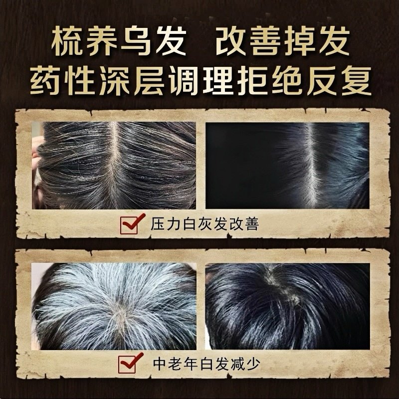 何首乌合香梳生发养发头皮按摩梳子防脱中医头部经络梳,淘宝优惠券,粉丝福利购,淘宝优惠卷