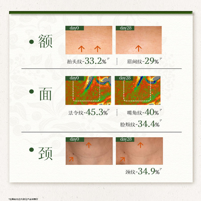 限定礼盒佰草集仙草油抗皱套装