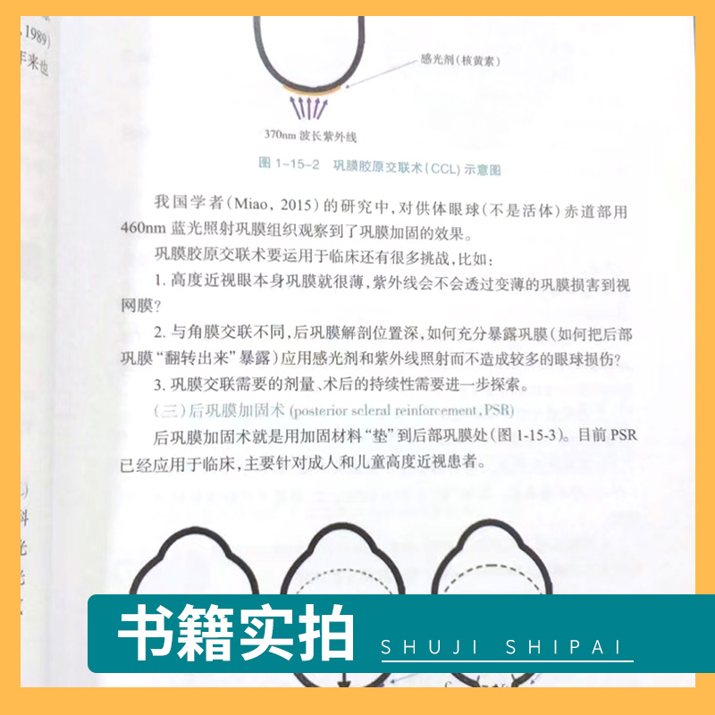 儿童视光 你问我答 辑 收集 整理了一线视光工作者常遇到的近视 视光相关问题 梅颖 唐志萍主编 9787117312868 人民卫生出版社 - 图2