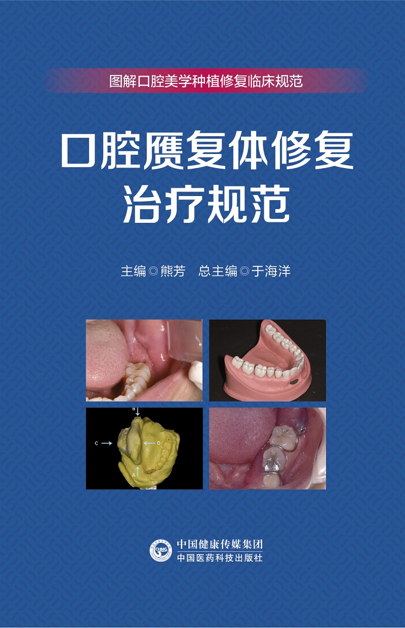 口腔赝复体修复治疗规范 图解口腔美学种植修复临床规范 熊芳 中国医药科技出版社 供全国各级医疗机构口腔医师 口腔护士等参考