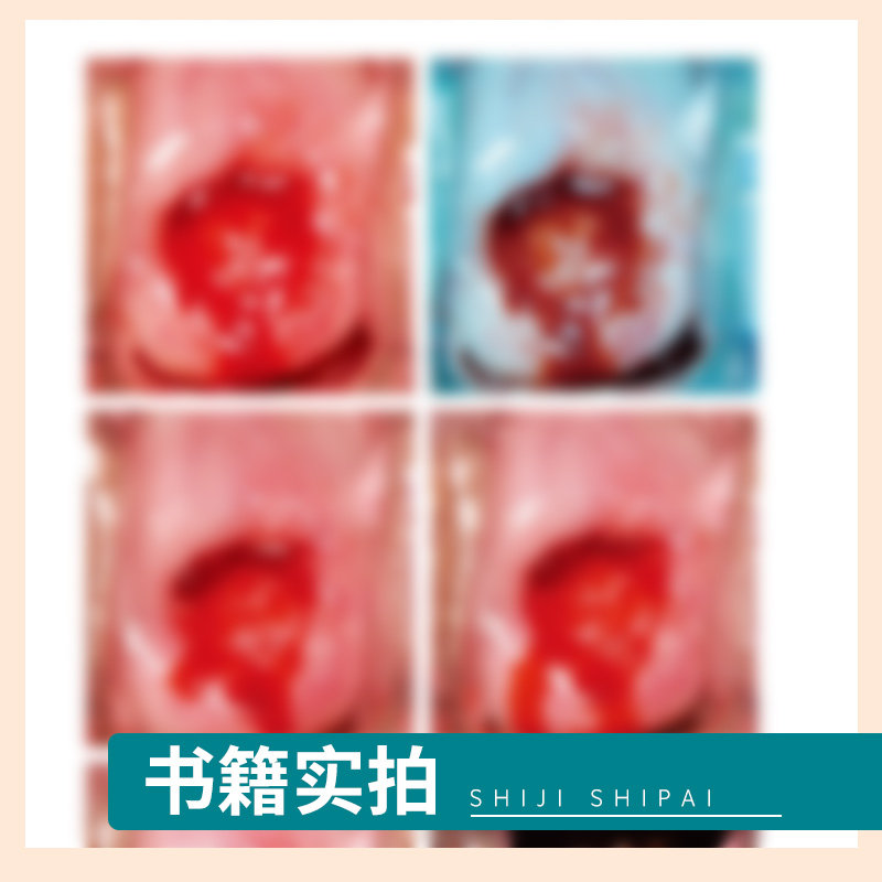 阴道镜技术入门和提高 赵健 主编 宫颈病变的病理组织学基础 阴道镜精准筛查 宫颈出血 子宫颈癌 人民卫生出版社 9787117319546